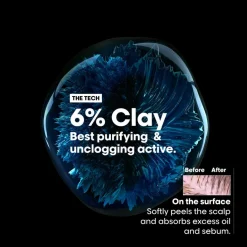 L'Oréal Professionnel Hovedbundspleje><noscript><img width=