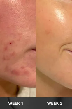 Paula's Choice Masker|Renseprodukter<Skin Perfecting 2% BHA Liquid Exfoliant