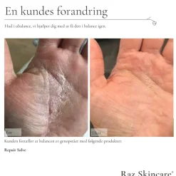 RAZ Skincare Dagcreme><noscript><img width=