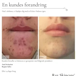 RAZ Skincare Dagcreme><noscript><img width=