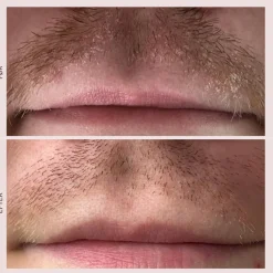 Pudderdåserne Skæl Serum< Serum