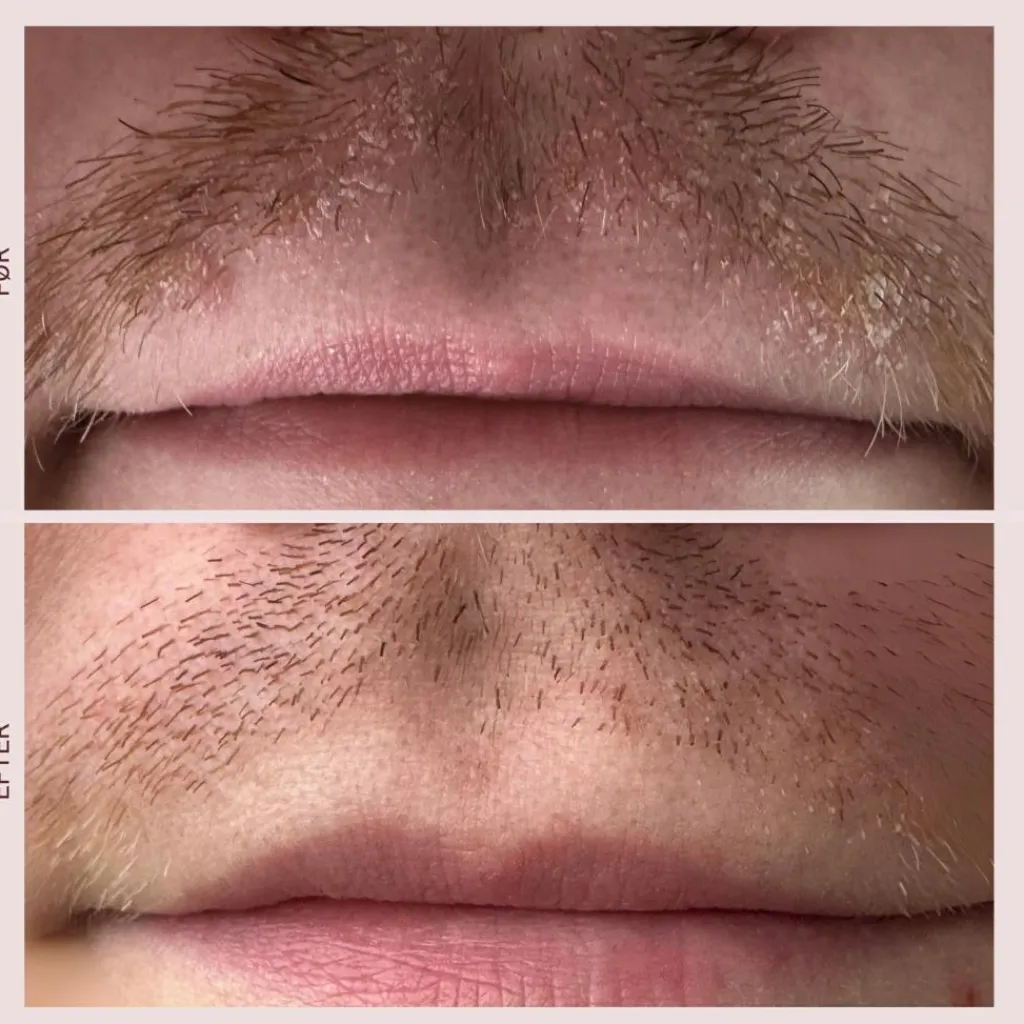 Pudderdåserne Skæl Serum< Serum