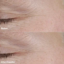 Clinique Natcreme<Smart Clinical Repair AM/PM Retinoid Balm