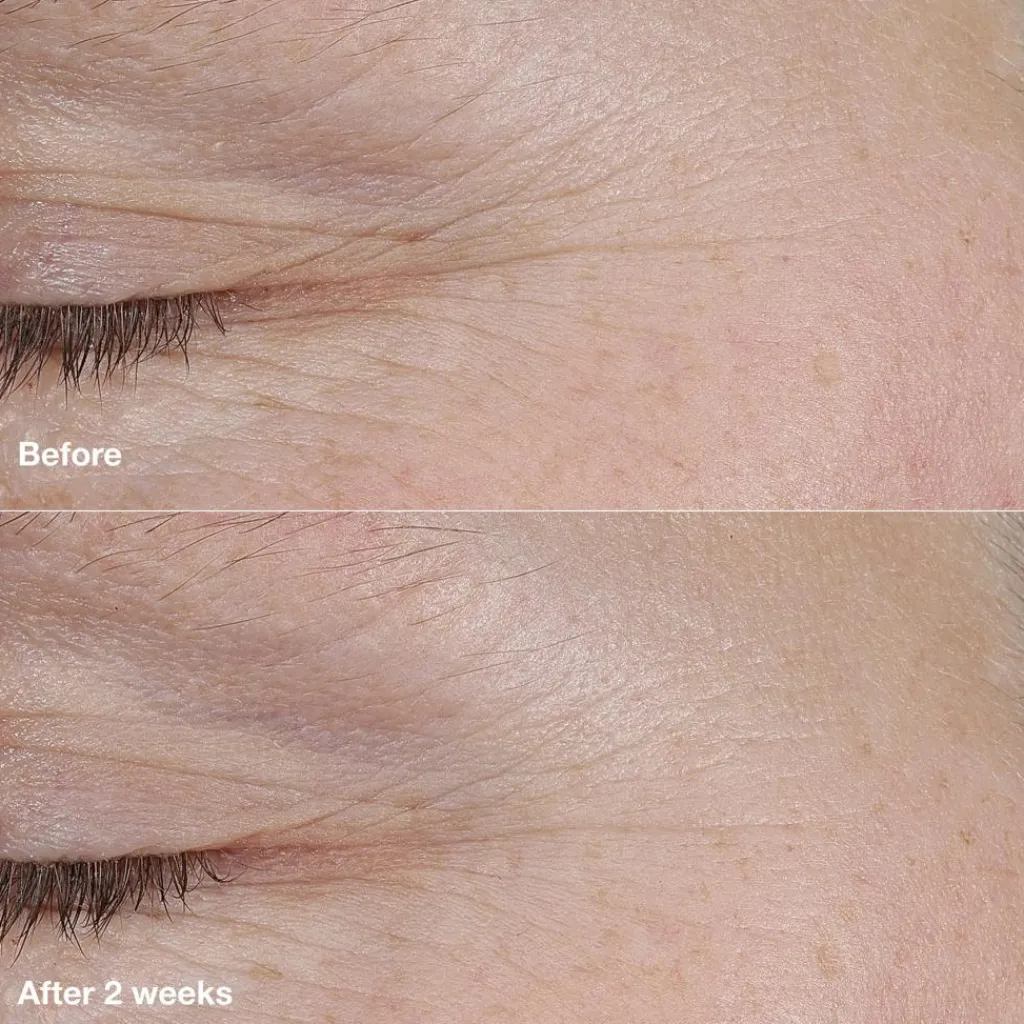 Clinique Natcreme<Smart Clinical Repair AM/PM Retinoid Balm