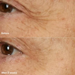 Clinique Masker><noscript><img width=