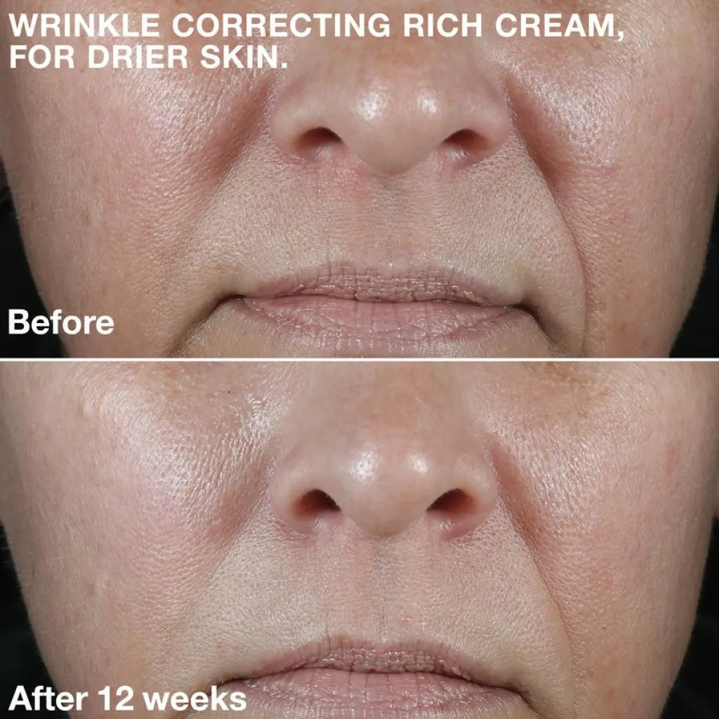 Clinique Dagcreme<Smart Clinical Repair Wrinkle Rich Cream