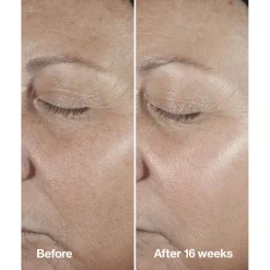 Clinique Smart Clinical Repair Wrinkle Correcting Serum< Serum
