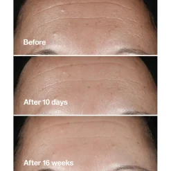 Clinique Smart Clinical Repair Wrinkle Correcting Serum< Serum