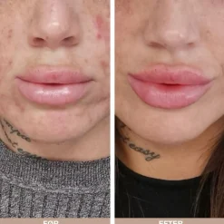 Australian Bodycare Ansigtspleje|Problemhud><noscript><img width=