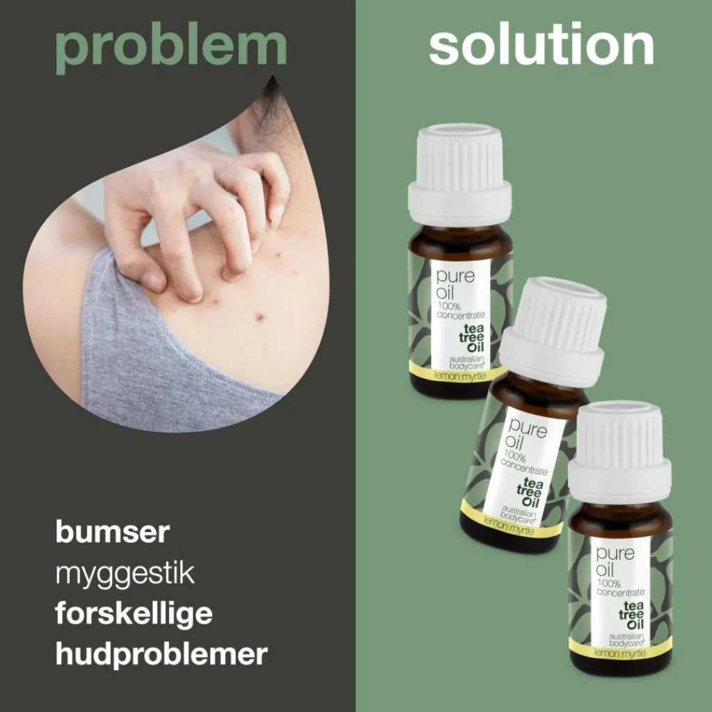 Australian Bodycare Ansigtsolie>Tea Tree Oil Lemon Myrtle