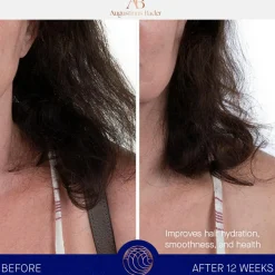 Augustinus Bader Leave-In Conditioner><noscript><img width=
