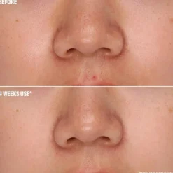 Benefit Rejsestørrelser><noscript><img width=