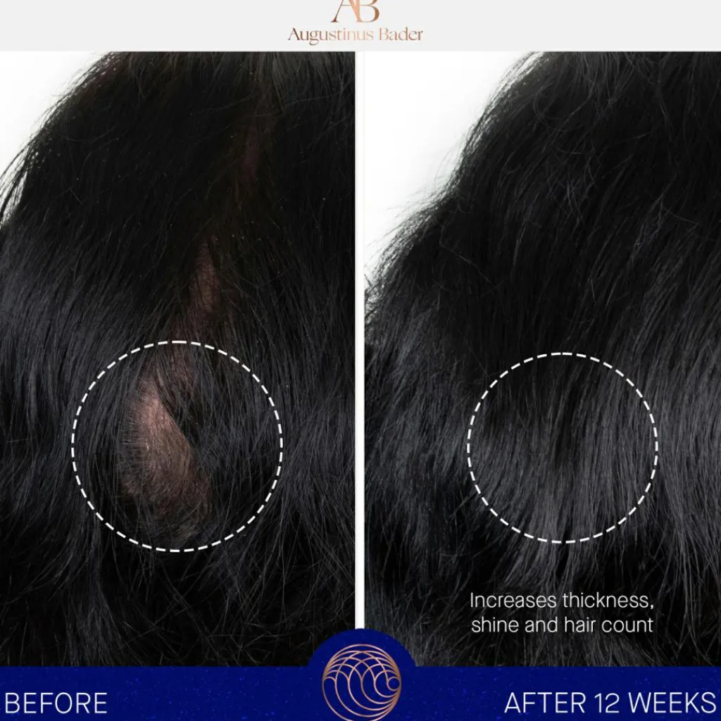 Augustinus Bader The Scalp Treatment< Hovedbundspleje