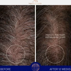 Augustinus Bader The Scalp Treatment< Hovedbundspleje