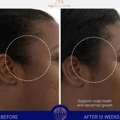 Augustinus Bader The Scalp Treatment< Hovedbundspleje