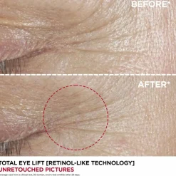 Clarins Øjenpleje><noscript><img width=