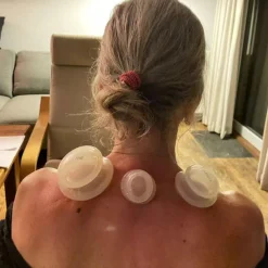 COOHÉ UFO Silicone Cupping Sæt< Massage