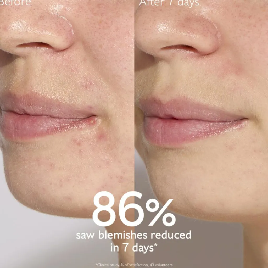 Caudalíe Vinopure Blemish Control Salicylic Serum< Serum